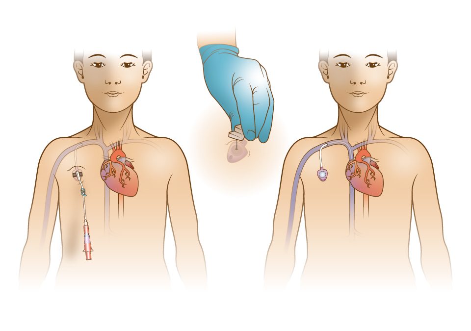 Medical illustrations of procedures